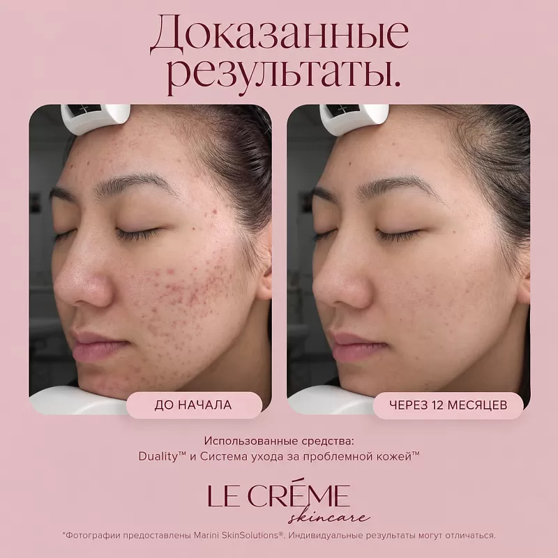 Marini SkinSolutions Duality 