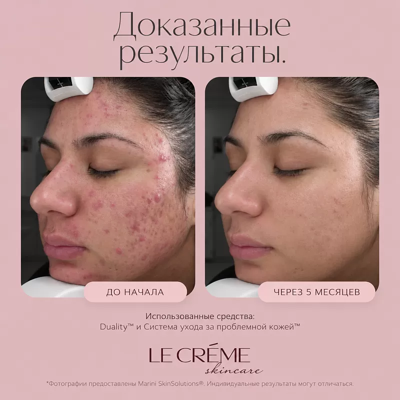 Marini SkinSolutions Duality 
