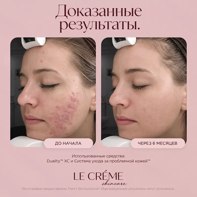 Marini SkinSolutions Duality 