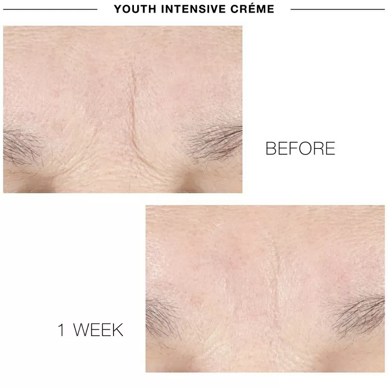 IS CLINICAL YOUTH INTENSIVE CREME