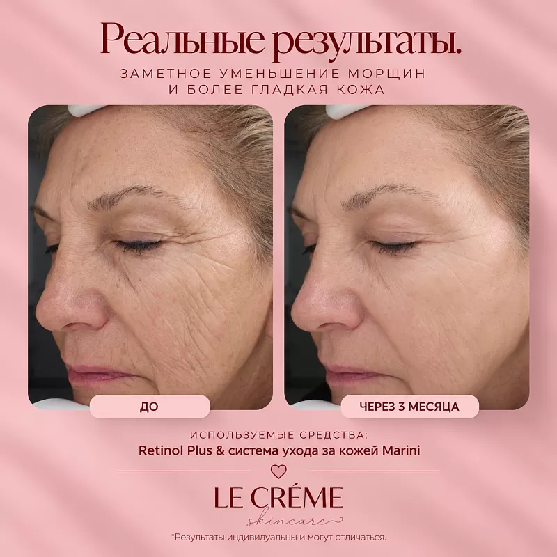 Marini SkinSolutions Retinol Plus