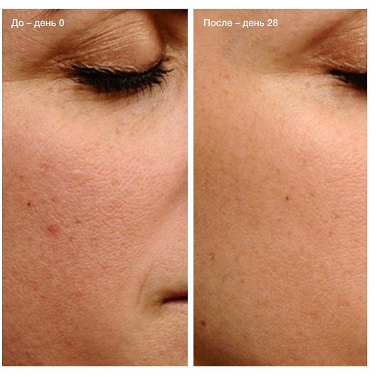 Endor Anti-aging Cream