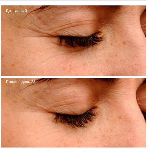 Endor Anti-Aging Eye Contour Cream