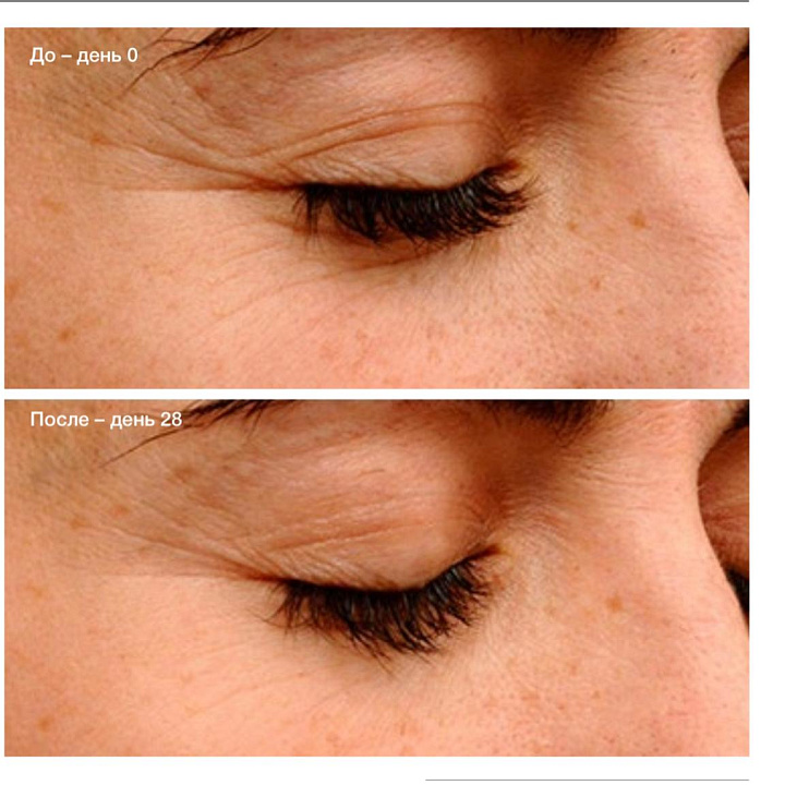 Endor Anti-Aging Eye Contour Cream