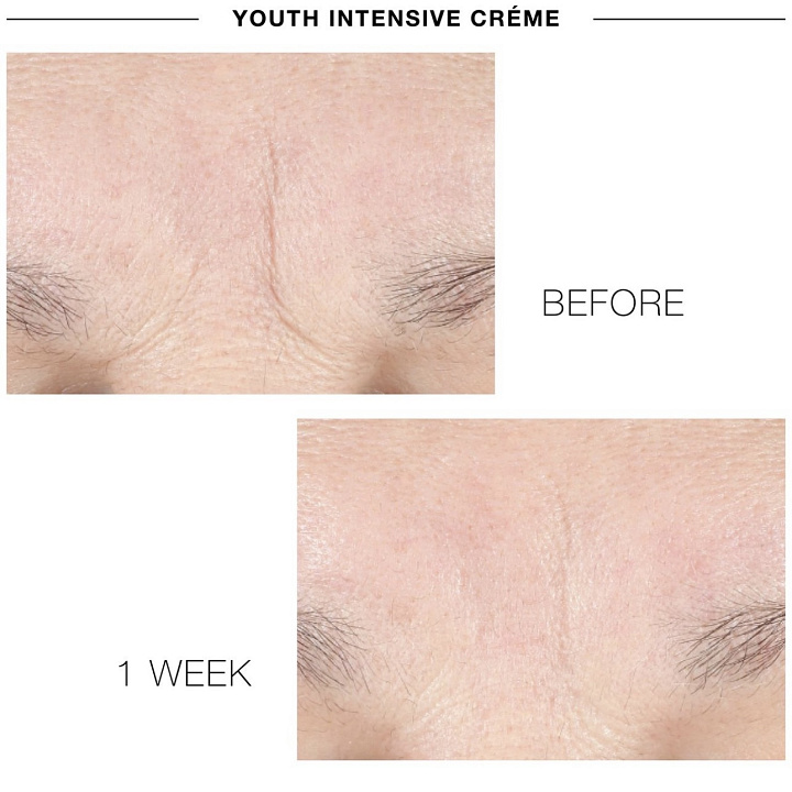 IS CLINICAL YOUTH INTENSIVE CREME