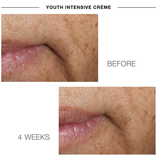 IS CLINICAL YOUTH INTENSIVE CREME