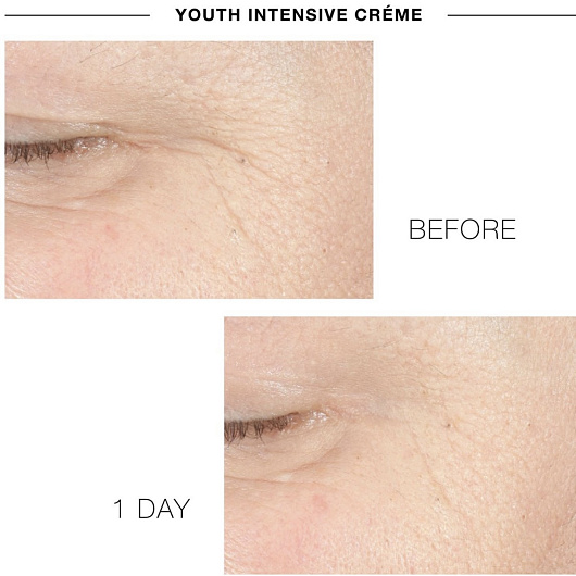 IS CLINICAL YOUTH INTENSIVE CREME