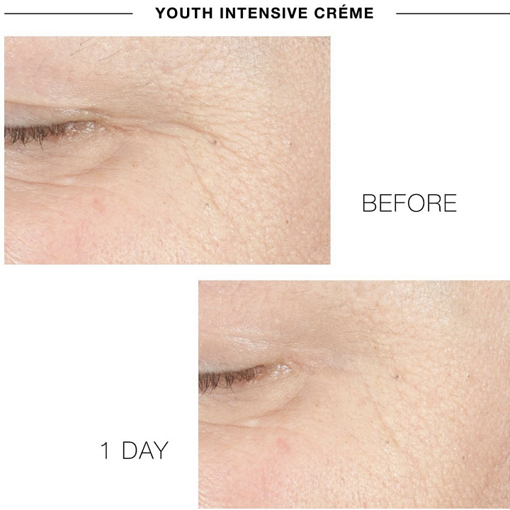 IS CLINICAL YOUTH INTENSIVE CREME