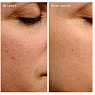 Endor Anti-aging Cream
