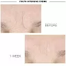 IS CLINICAL YOUTH INTENSIVE CREME